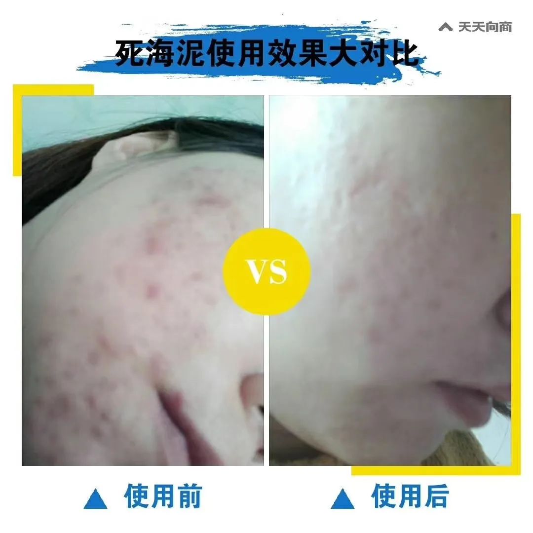 死海泥洗面膜怎么样,死海泥面膜的神奇功效是什么