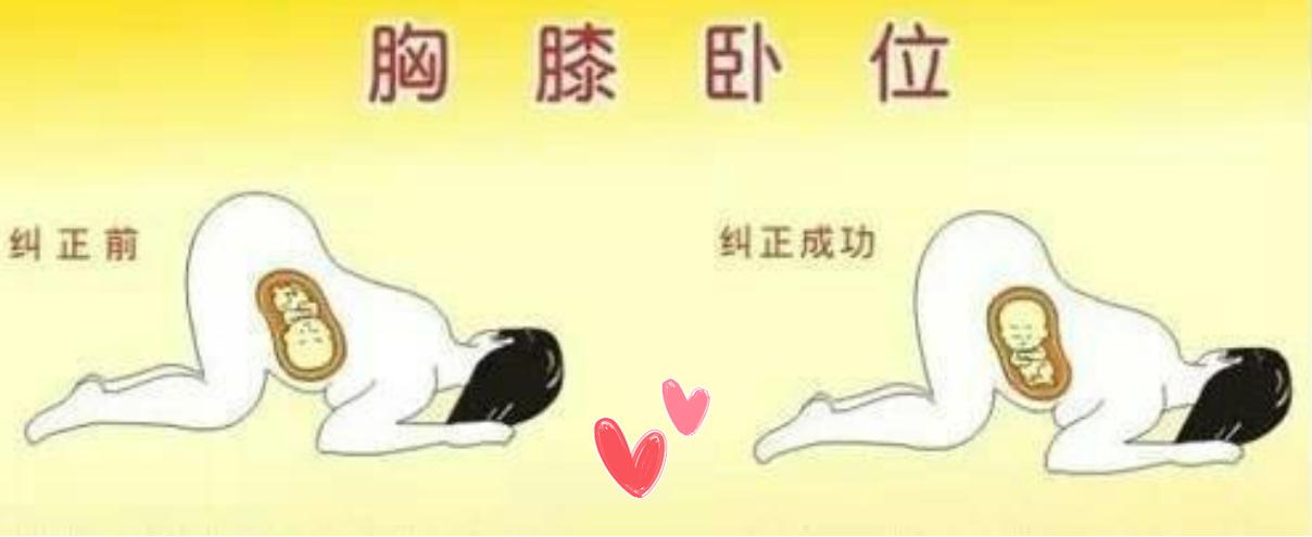 孕期孕后冷知识,孕期冷知识宝宝的便便
