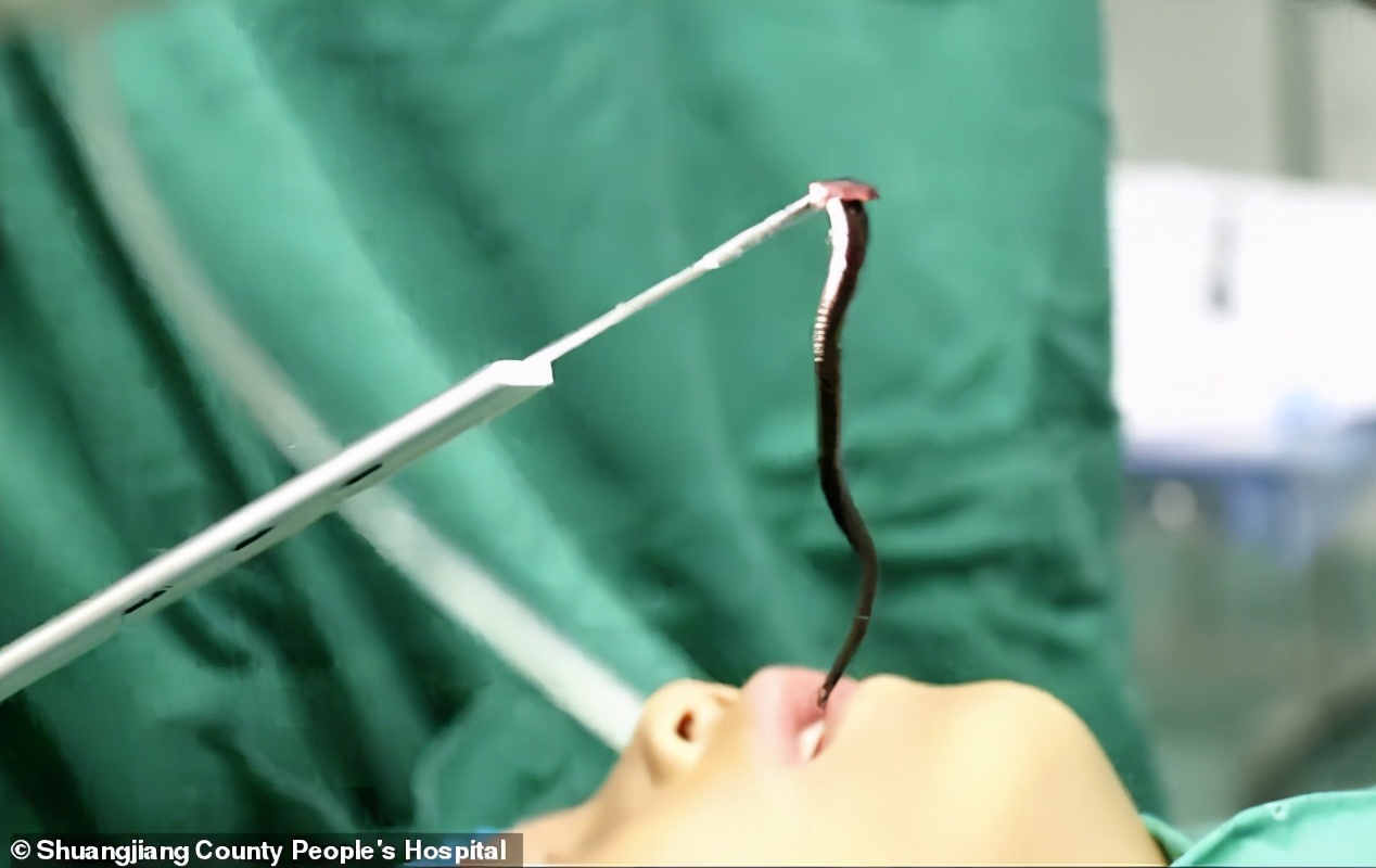 男孩被蚂蚁吓死,蚂蝗寄生在五岁男孩身体里一年