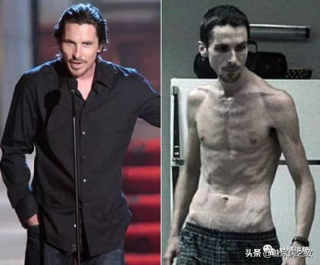 解读2型糖尿病的高血糖治疗路径