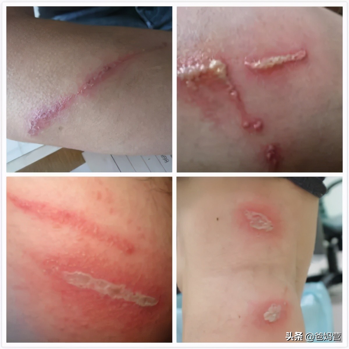 妈妈一拍小孩差点毁容,妈妈拍到孩子的恐怖画面