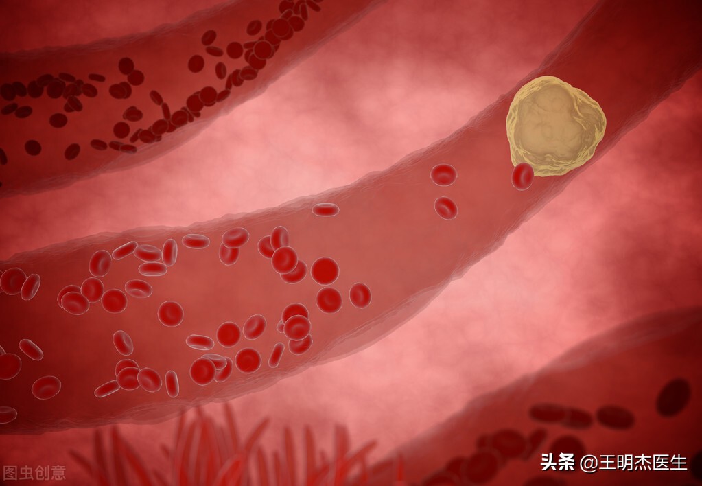 小腿运动容易肿胀发硬怎么回事,小孩小腿局部肿胀发硬怎么回事