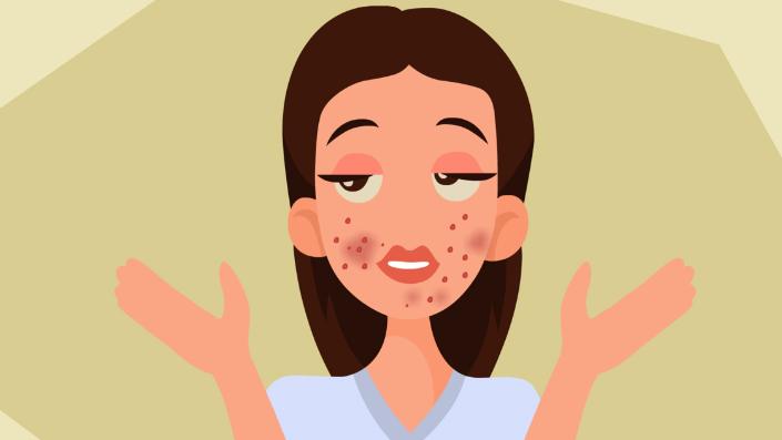 红霉素软膏下面肿可以涂吗,红霉素软膏涂在眼睑内会咋样