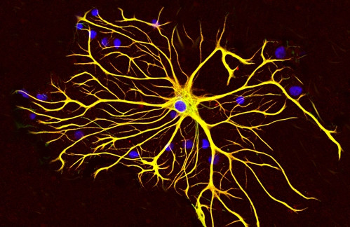 下肢截瘫康复成功案例,全国治疗截瘫最新突破