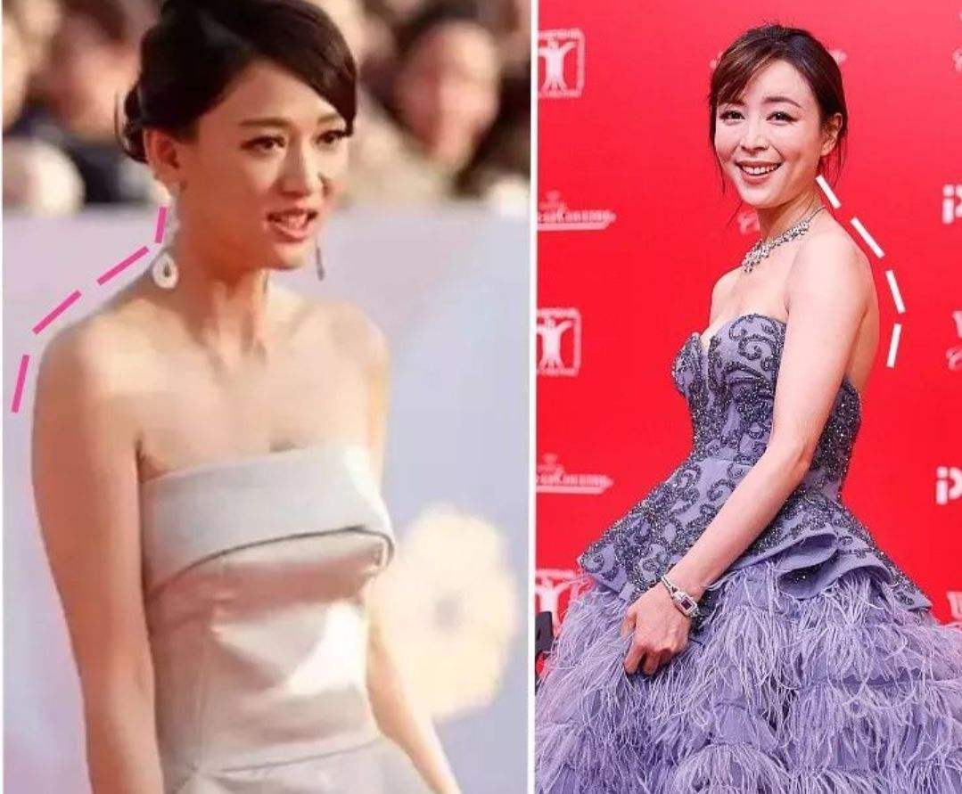 5个少儿常见不良体态，家长不重视影响深远