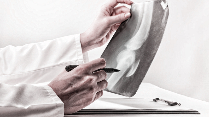 70岁老人半月板磨损三度怎么治疗,膝盖半月板磨损三度