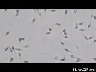 生殖科医生讲述：我在取精室里的秘密……