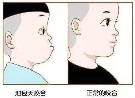 孩子牙齿长歪了怎么办？什么时候适合做矫正？