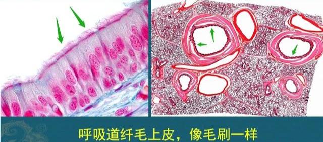 肺里咳出的痰对身体有害吗,从肺里咳出痰带血丝