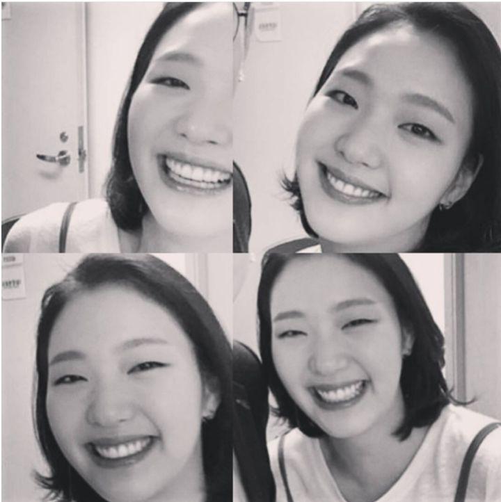 单眼皮怎么整容变双眼皮,嫌弃自己双眼皮小怎么办