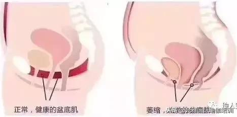 产后修复知识大全书本,科普产后康复有必要做吗