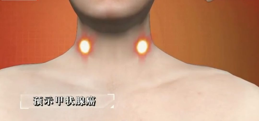 人体危险三角区的危害,身体三角区有哪些危险