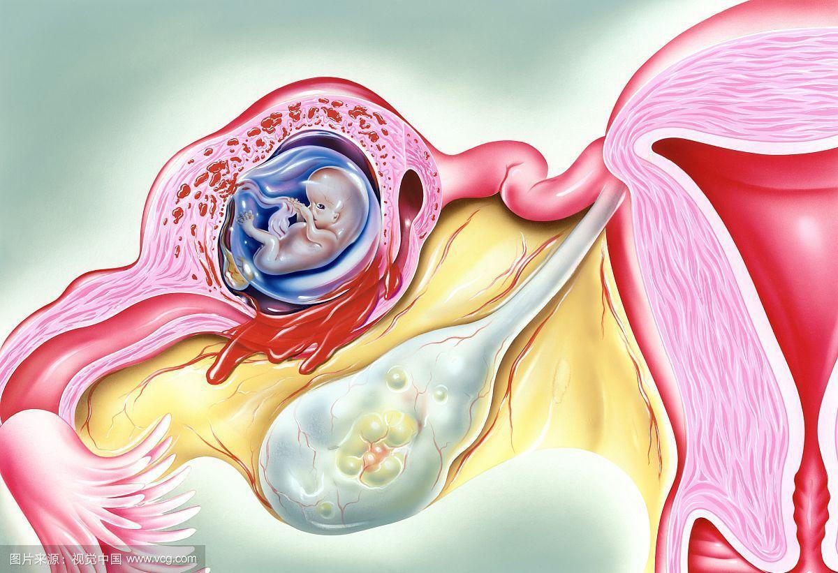 腹痛急剧怎么办？当然是快速准确诊断病因最重要，否则没法治疗