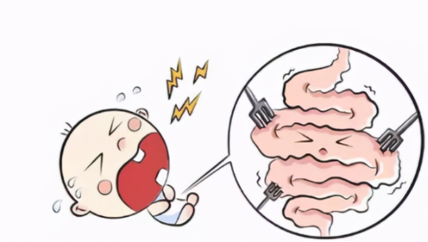 婴儿肠痉挛大哭最快缓解办法,婴儿肠痉挛哭得厉害怎么办