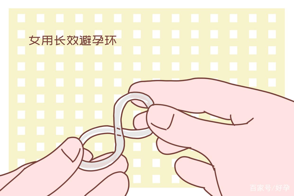 新型避孕环使用方法和安装,新一代避孕环
