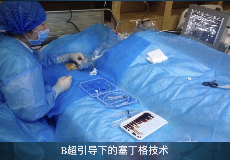 picc日常注意事项,picc生命的通道