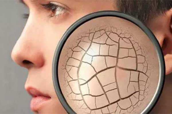 冬泳皮肤皲裂粗糙,会阴处皮肤皲裂