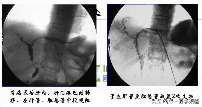 「医影传声」上海交通大学医学院附属瑞金医院卢湾分院放射科主任