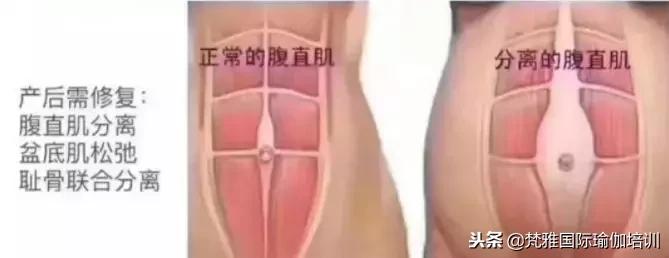 产后修复知识大全书本,科普产后康复有必要做吗