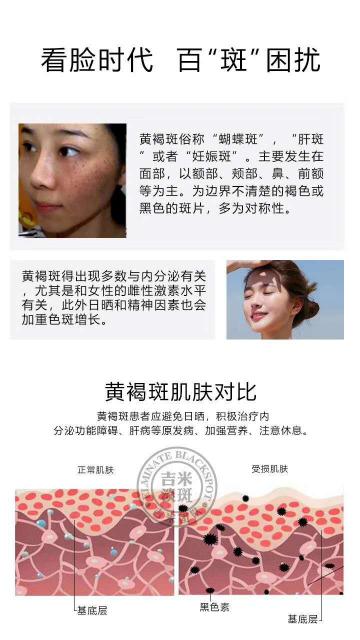 肌肤暗黄有色斑?吉米雪颜素美白淡斑体验套让肌肤重生