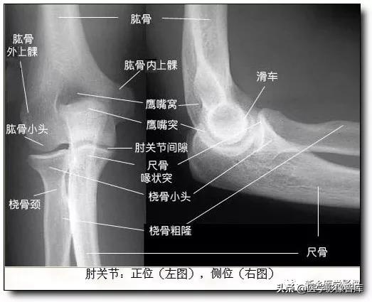 肘关节x线测量,肘关节骨骺示意图