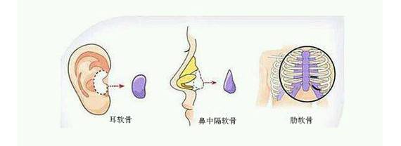 鼻梁高但不精致如何调整,塌鼻梁如何拯救侧颜