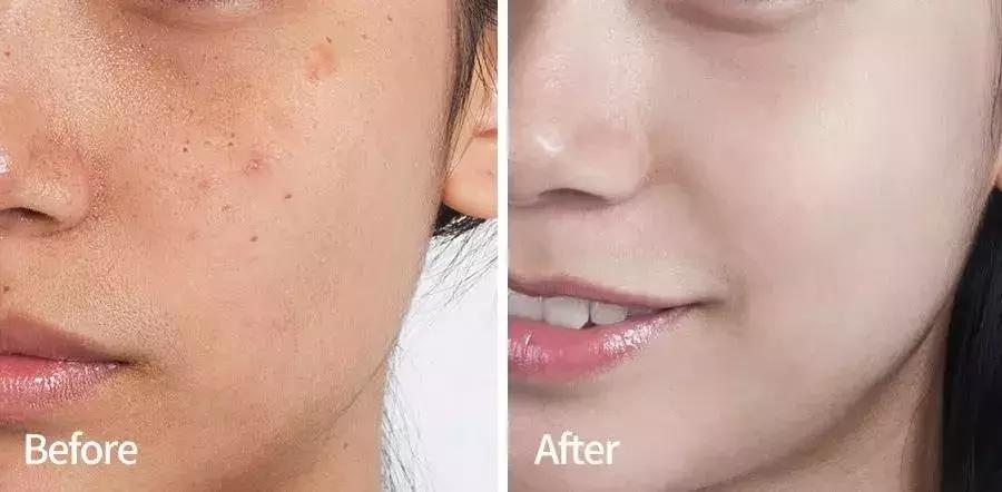 韩国小灯泡美白精华怎么样,韩国小灯泡精华真的能变白吗