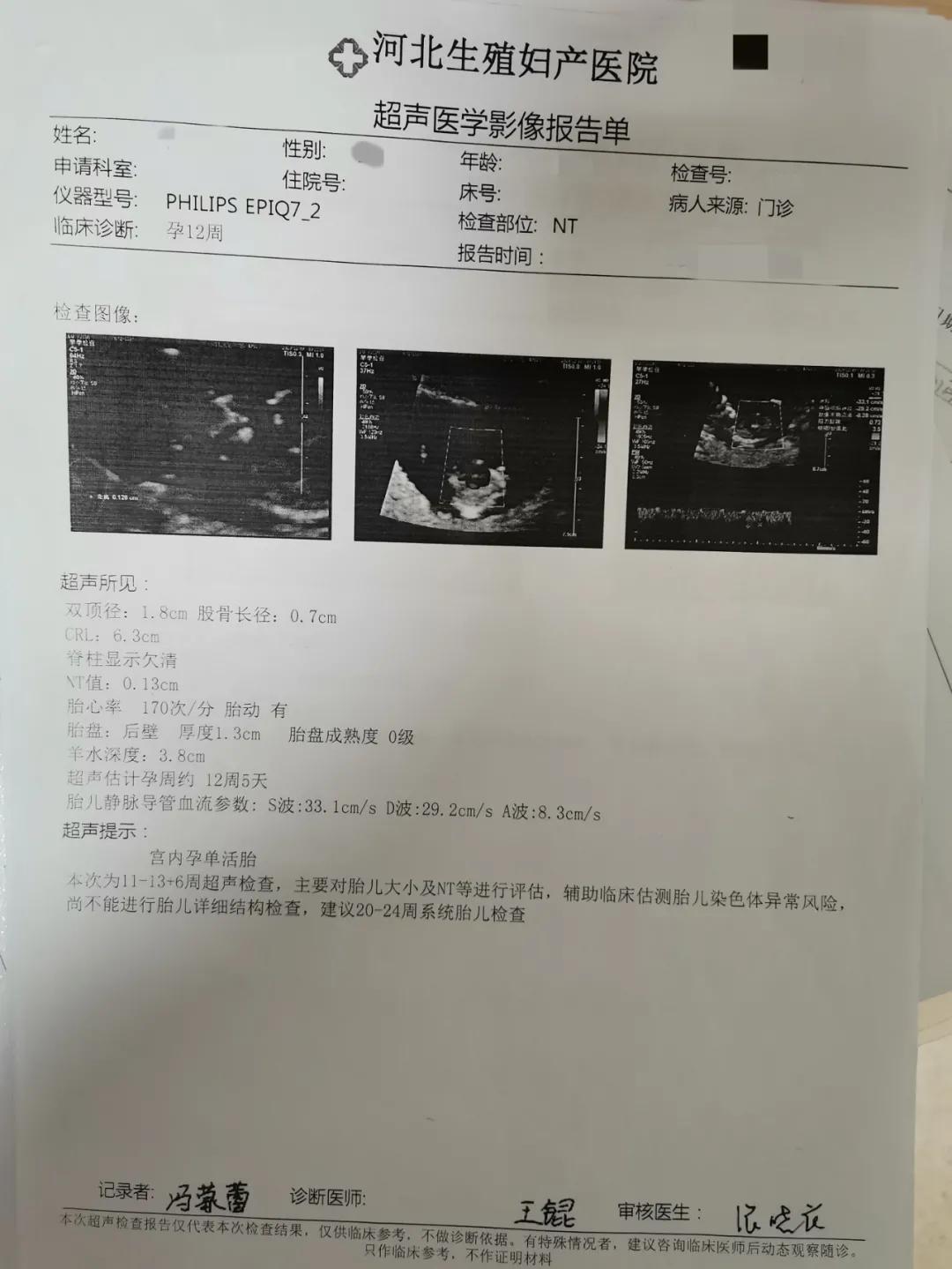 移植卵泡成功案例,一个优质胚胎试管会成功吗
