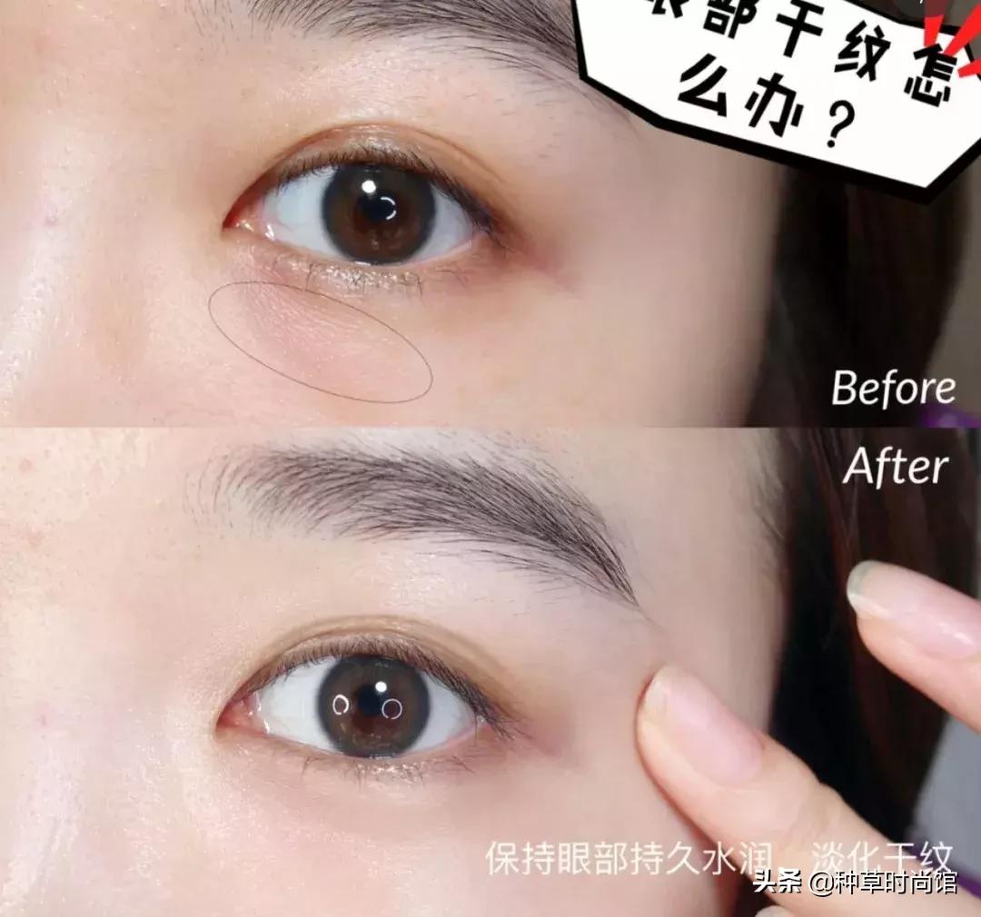 眼霜是否越贵越好,眼霜越贵越好吗