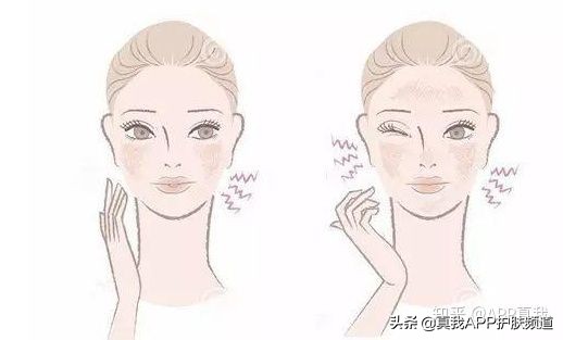 habag露适合油敏皮吗,habag露适合油敏肌吗