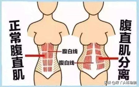 产后耻骨分离瑜伽矫正动作,产后腹直肌分离修复手法教程