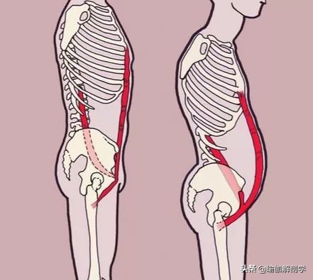 练瑜伽可以矫正骨盆前倾,练瑜伽时骨盆如何转动
