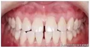 诺尔口腔牙齿矫正怎么样,淄博诺尔漫齿科种植牙价格