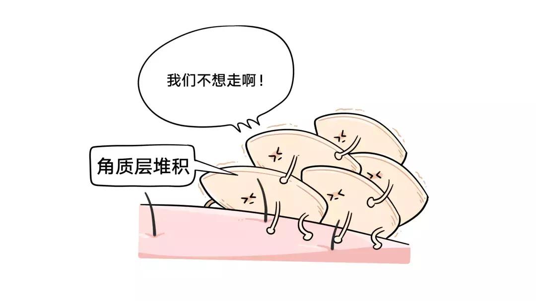 10年长痘经验,10年长痘趁早治