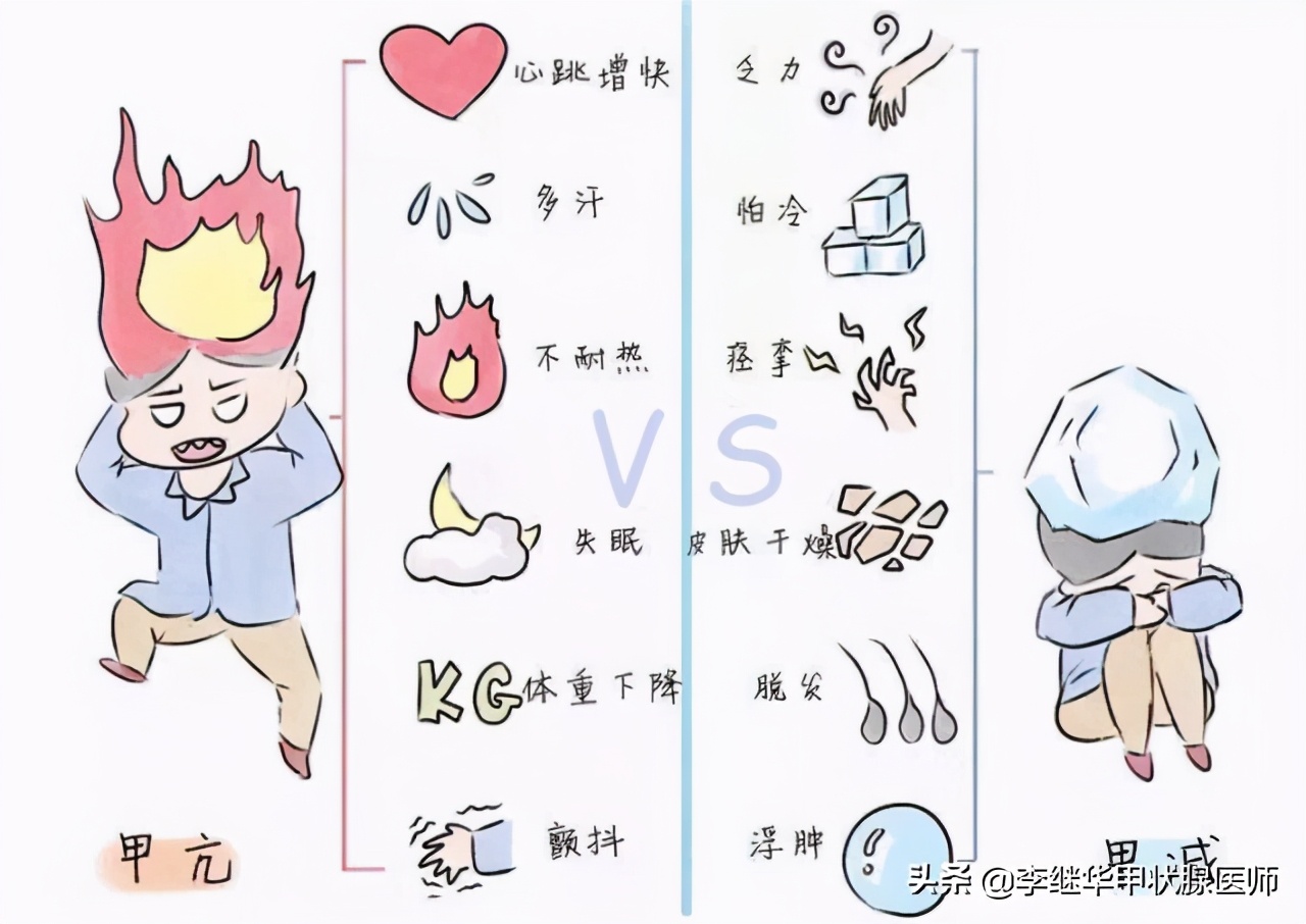 甲减突然停止吃优甲乐会怎样,甲减优甲乐调整口诀