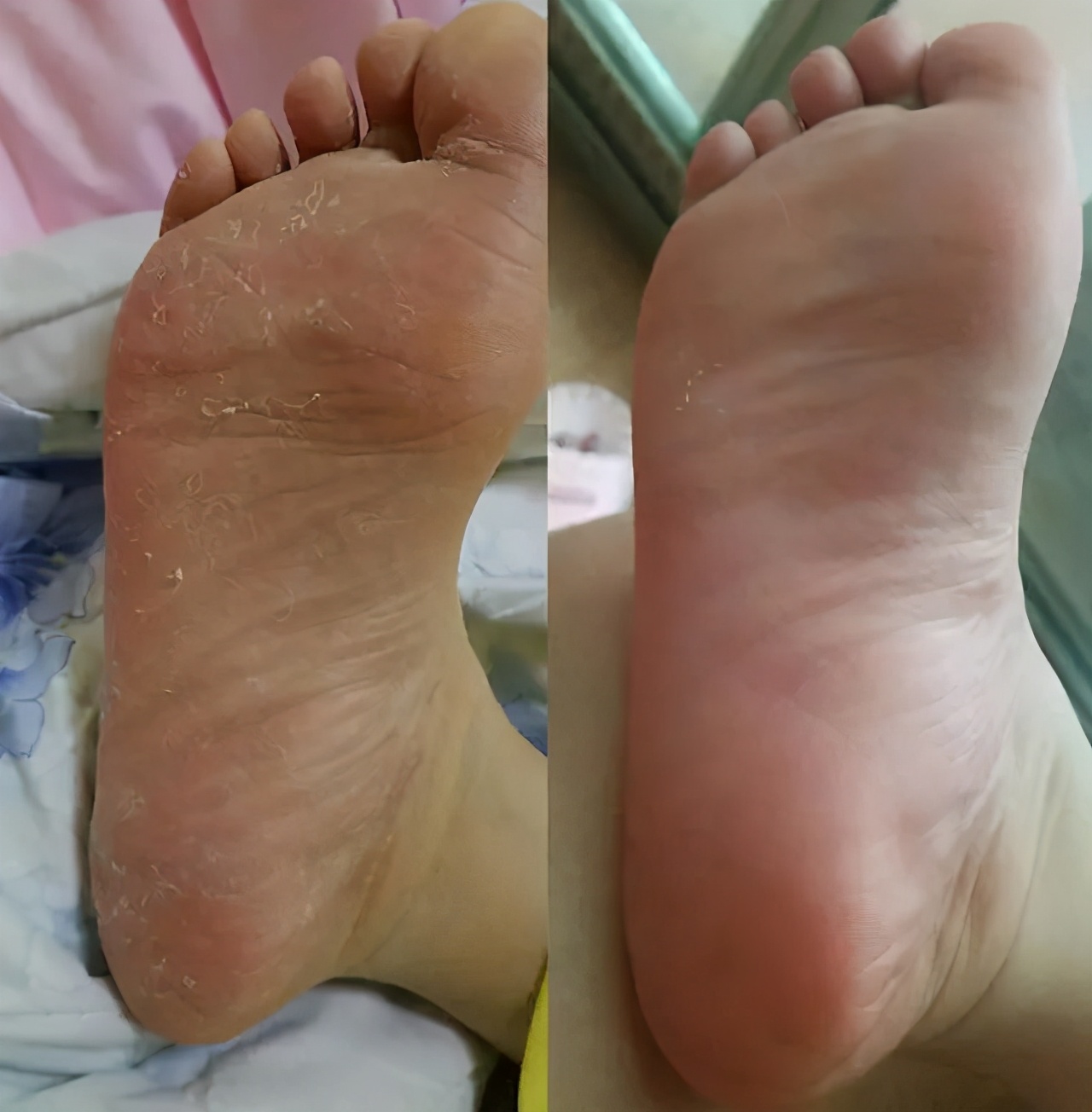 光脚不穿袜子穿鞋的好处,光脚不穿袜子会不会臭脚