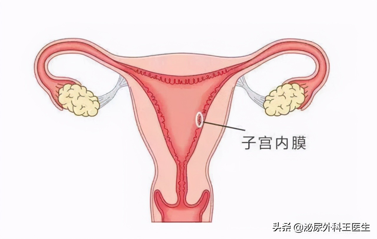 打过胎身体有哪些痕迹,女性打过胎会留下什么痕迹