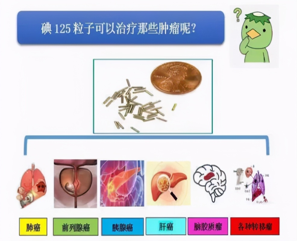 肿瘤康复神器,治疗肿瘤先进核技术