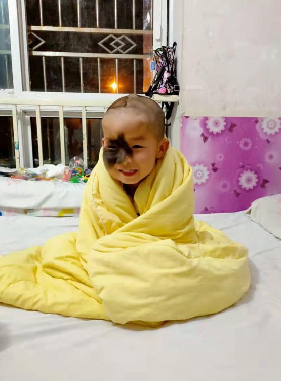 5岁男孩头上长500克重“气球”,历尽5年艰辛只为早日换脸