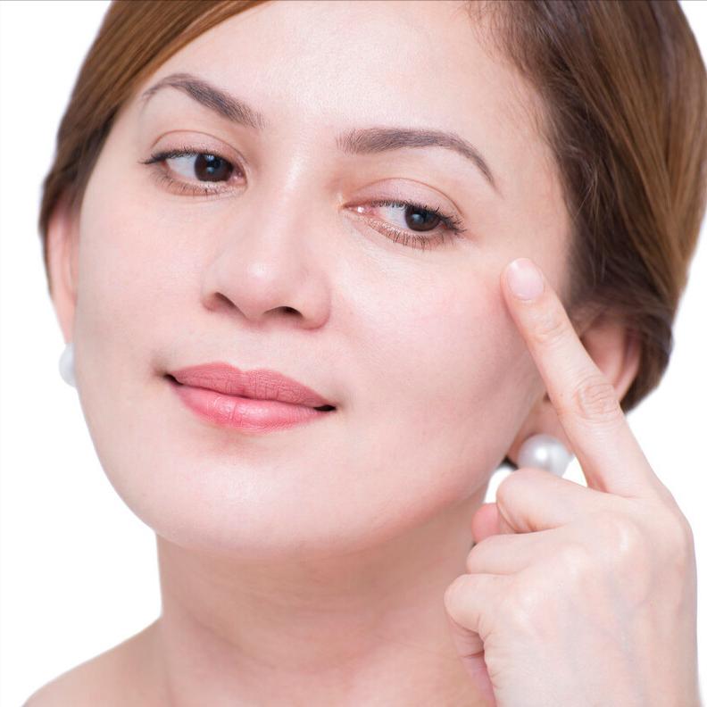 双眼皮刚刚做完和一个月后的对比,双眼皮做完太自然和没做一样