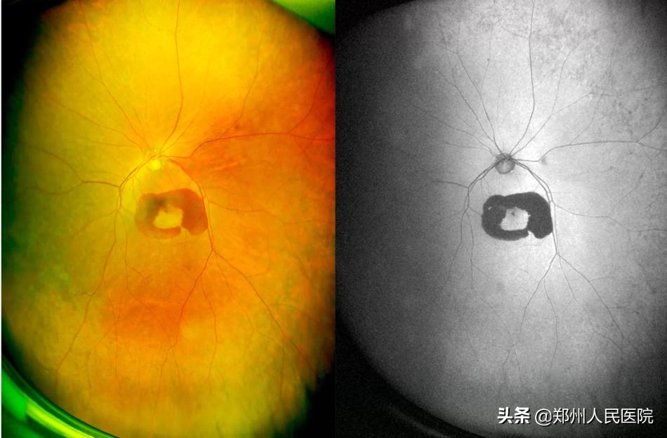 只有加倍爱护Ta，才能更清晰的看世界