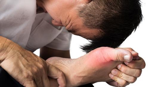 导致痛风的九大诱因你了解了吗,4个常见表现提示你患上痛风啦