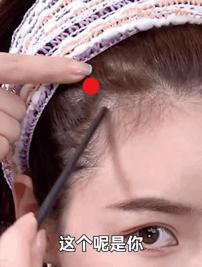 颅顶高了但发际线高怎么办,颅顶低的几种补救办法