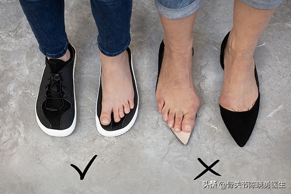 大脚骨是骨质增生吗,为什么会有大脚骨这种脚型