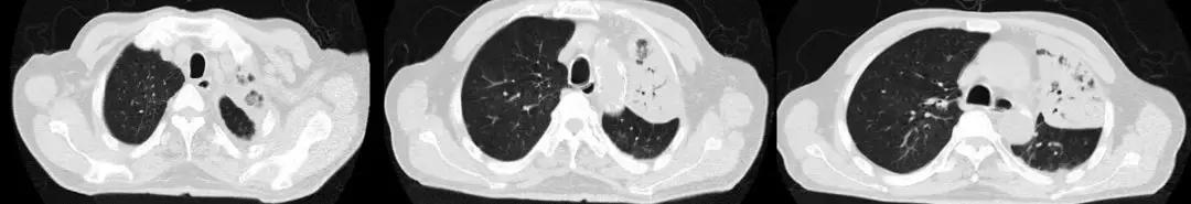 抗菌药物不合理处方分析,抗菌药物用药不合理的表现