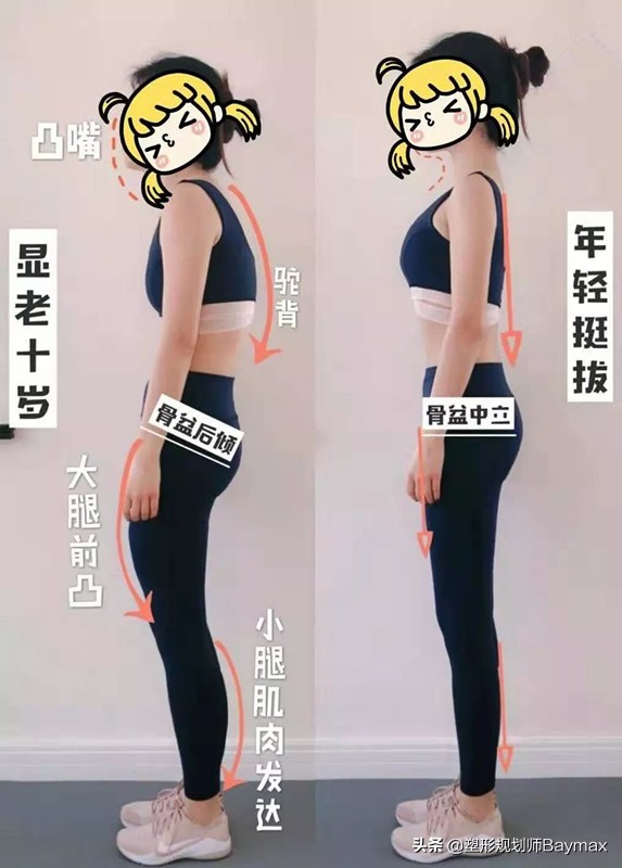 你以为的翘臀有可能是骨盆前倾,你以为的臀部训练