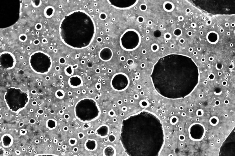 少年白头发吃什么根治白发,两鬓长白发的原因及治疗方法