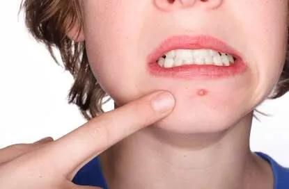 床单睡久了容易螨虫成窝？教你一新招，比太阳暴晒效果好