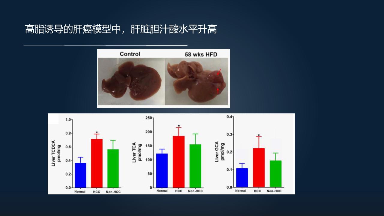 「图文实录」郑晓皎：18分钟详解菌群-胆汁酸与消化系统肿瘤