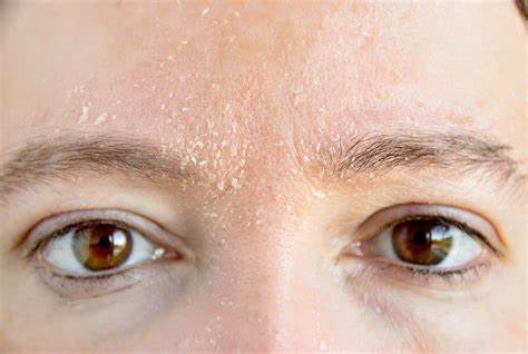 面部红肿灼热瘙痒是什么原因,面部瘙痒发红怎么治疗